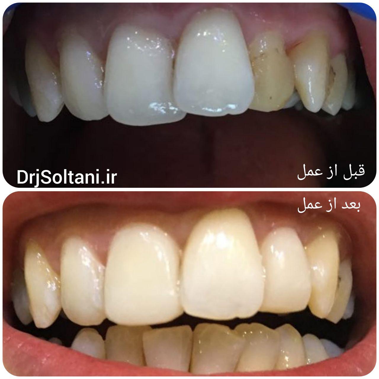 نمونه کار دندانپزشکی
