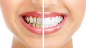 هفت دلیل اصلی آسیب دندان کدامها هستند؟