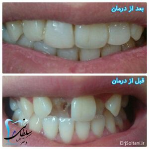 درمان دندانپزشکی